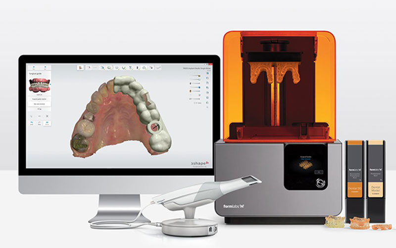 technology of intra-oral 3D scan and creation of dental prosthesis (dental veneer, crown, dental implant, bridge and fixed and removable denture) used at the dental office in Algiers in Algeria Alpha dental by the dental surgeon Dr Younes DOUKANI in Algiers
