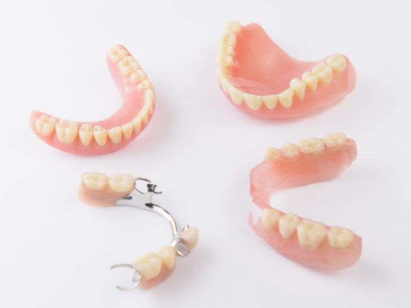 Removable dental prosthesis dental surgeon Dr Younes Doukani Dental office Alpha dental Algiers Algeria